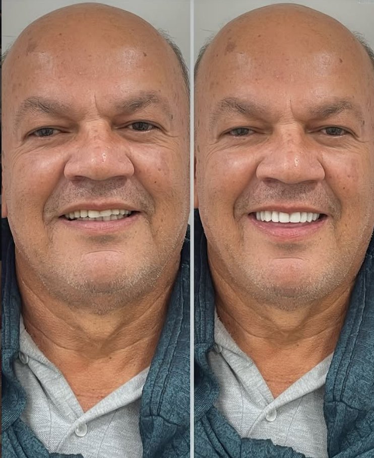 Antes e Depois 1