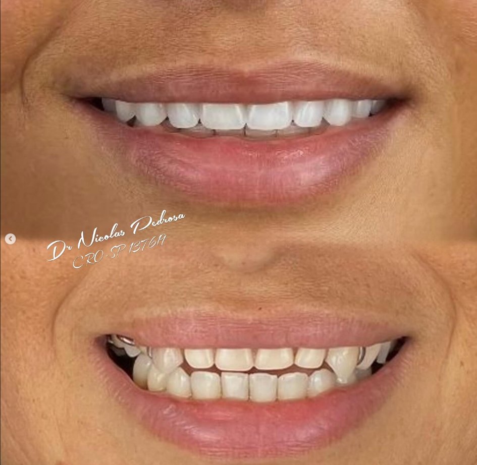 Antes e Depois 3